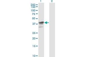 Western Blot analysis of MAPK3 expression in transfected 293T cell line by MAPK3 monoclonal antibody (M04), clone 1F7. (ERK1 抗体  (AA 279-379))