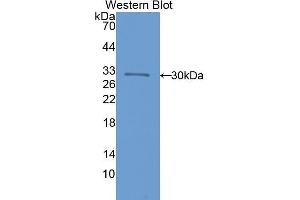 Western Blotting (WB) image for anti-Interleukin 17 Receptor C (IL17RC) (AA 73-330) antibody (ABIN1859363)