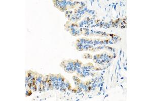 Immunohistochemistry of paraffin-embedded mouse lung using RGS5 antibody (ABIN6130676, ABIN6146924, ABIN6146925 and ABIN6222790) at dilution of 1:100 (40x lens). (RGS5 抗体  (AA 1-181))