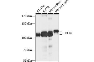 Western blot analysis of extracts of various cell lines, using PEX6 antibody (ABIN6133134, ABIN6145472, ABIN6145473 and ABIN6214721) at 1:1000 dilution. (PEX6 抗体  (AA 741-980))