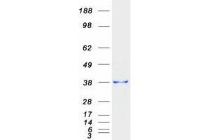 Western Blotting (WB) image for Signal Sequence Receptor, alpha (SSR1) protein (Myc-DYKDDDDK Tag) (ABIN2732706)