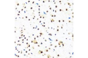 Immunohistochemistry of paraffin-embedded mouse brain using FUBP1 antibody. (FUBP1 抗体)