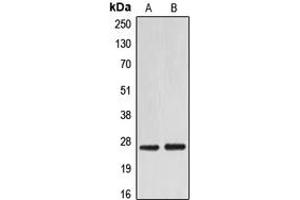 Western blot analysis of EIF4E expression in HEK293T (A), NIH3T3 (B) whole cell lysates. (EIF4E 抗体  (C-Term))