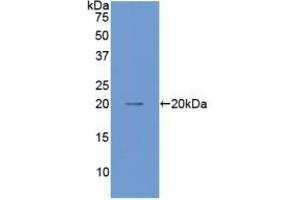 Detection of Recombinant ANGPT1, Mouse using Polyclonal Antibody to Angiopoietin 1 (ANGPT1) (Angiopoietin 1 抗体  (AA 253-429))