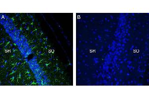 Expression of TREM2 in mouse hippocampus in a kainic acid neurodegeneration model. (TREM2 抗体  (Extracellular, N-Term))