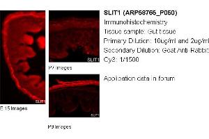 Image no. 1 for anti-Slit Homolog 1 (SLIT1) (Middle Region) antibody (ABIN504532) (SLIT1 抗体  (Middle Region))