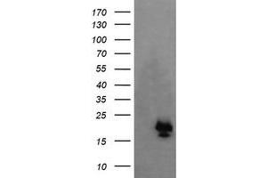 Image no. 1 for anti-NFKB Inhibitor Interacting Ras-Like 1 (NKIRAS1) antibody (ABIN1499742) (NKIRAS1 抗体)