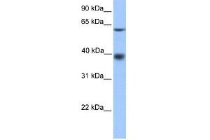 WB Suggested Anti-MFSD4 Antibody Titration: 0. (MFSD4 抗体  (N-Term))