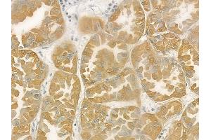 ABIN6258318 and ABIN6275481 at 1/100 staining human normal kidney tissue by IHC-P. (RGS5 抗体  (Internal Region))