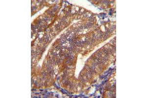 POSTN Antibody immunohistochemistry analysis in formalin fixed and paraffin embedded human uterus tissue followed by peroxidase conjugation of the secondary antibody and DAB staining. (Periostin 抗体  (C-Term))