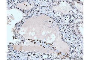 IHC analysis of CD163 using anti-CD163 antibody (ABIN5693082). (CD163 抗体  (AA 47-201))