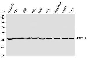 Western blot analysis of Cytokeratin 19 using anti-Cytokeratin 19 antibody (ABIN3043288). (Cytokeratin 19 抗体  (C-Term))