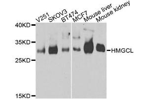 Western blot analysis of extracts of various cell lines, using HMGCL antibody (ABIN5975709) at 1/1000 dilution. (HMGCL 抗体)