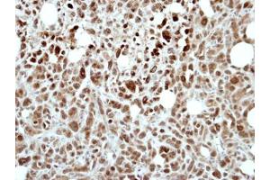 IHC-P Image Immunohistochemical analysis of paraffin-embedded PC9 xenograft, using RING1, antibody at 1:500 dilution. (RING1 抗体)