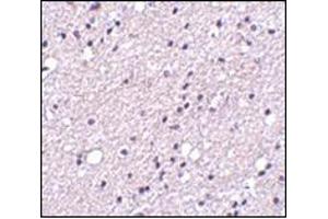 Immunohistochemistry of NK3R in human brain tissue with this product at 5 μg/ml. (TACR3 抗体  (Center))