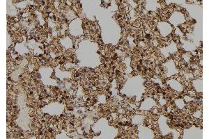ABIN6273664 at 1/100 staining Rat lung tissue by IHC-P. (IFI35 抗体  (C-Term))