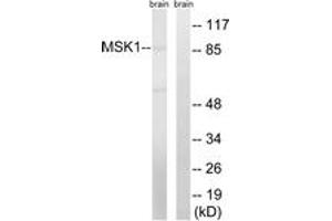 Western blot analysis of extracts from mouse brain cells, using MSK1 (Ab-212) Antibody. (MSK1 抗体  (AA 181-230))