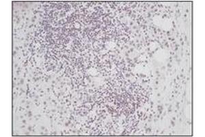Image no. 1 for anti-Connective Tissue Growth Factor (CTGF) antibody (ABIN181700) (CTGF 抗体)