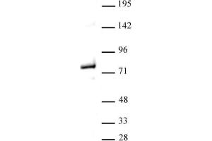 Western blot of Menin antibody. (Menin 抗体  (C-Term))