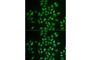 Immunofluorescence analysis of U2OS cells using LNX1 antibody (ABIN5973876). (LNX1 抗体)