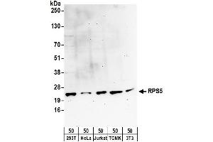 anti-Ribosomal Protein S5 (RPS5) (AA 50-100) antibody