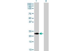 Western Blot analysis of CABP7 expression in transfected 293T cell line by CABP7 MaxPab polyclonal antibody. (CABP7 抗体  (AA 1-215))