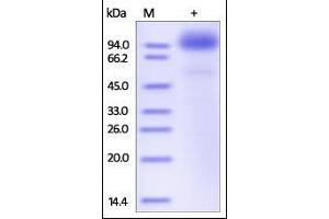 Human SCARB2, Fc Tag on SDS-PAGE under reducing (R) condition. (SCARB2 Protein (AA 27-432) (Fc Tag))