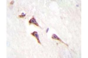 Immunohistochemistry analyzes of mTOR antibody in paraffin-embedded human brain tissue. (MTOR 抗体)