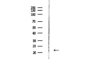 anti-Heart and Neural Crest Derivatives Expressed 1 (HAND1) (Internal Region) antibody