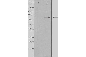 Western blot analysis of extracts from HeLa cells using PNPLA8 antibody. (PNPLA8 抗体  (C-Term))
