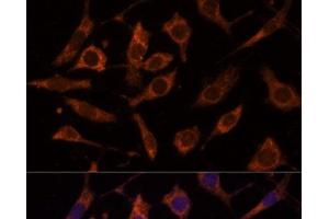 Immunofluorescence analysis of L929 cells using RPL24 Polyclonal Antibody at dilution of 1:100 (40x lens). (RPL24 抗体)