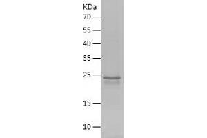 Western Blotting (WB) image for Islet Amyloid Polypeptide (IAPP) (AA 34-70) protein (His-IF2DI Tag) (ABIN7283286) (Amylin/DAP Protein (AA 34-70) (His-IF2DI Tag))