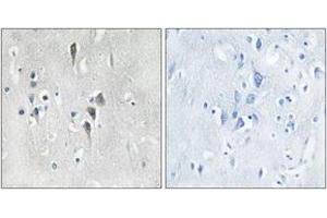 Immunohistochemistry analysis of paraffin-embedded human brain tissue, using CaMK2 alpha/delta (Ab-286) Antibody. (CaMK2 alpha/delta 抗体  (AA 256-305))