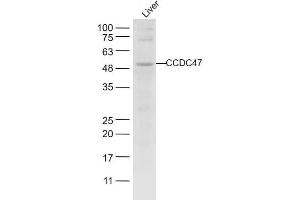 Mouse liver lysates probed with CCDC47 Polyclonal Antibody, unconjugated  at 1:1000 overnight at 4°C followed by a conjugated secondary antibody for 60 minutes at 37°C. (CCDC47 抗体  (AA 375-483))