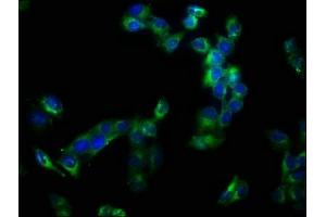 Immunofluorescence staining of Hela cells with ABIN7150034 at 1:133, counter-stained with DAPI. (A Disintegrin and Metallopeptidase Domain 1a (ADAM1A) (AA 214-504) 抗体)
