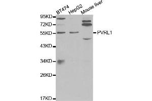 Western blot analysis of extracts of various cell lines, using PVRL1 antibody (ABIN5971069) at 1/1000 dilution. (PVRL1 抗体)