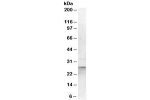 Western blot testing of human cerebellum lysate with OTUB2 antibody at 1ug/ml. (OTUB2 抗体)