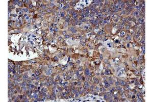 IHC analysis of RRS1 using anti-RRS1 antibody (ABIN7602918). (RRS1 抗体  (C-Term))