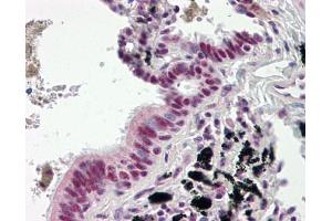 Image no. 1 for anti-DnaJ (Hsp40) Homolog, Subfamily C, Member 3 (DNAJC3) (AA 270-462) antibody (ABIN467547) (DNAJC3 抗体  (AA 270-462))