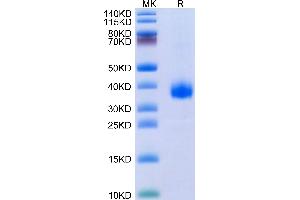 SDS-PAGE (SDS) image for SARS-CoV-2 Spike (B.1.640), (RBD) protein (His tag) (ABIN7274871)