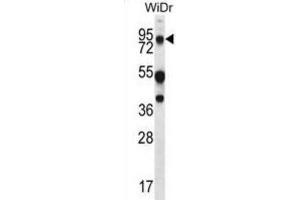 Western Blotting (WB) image for anti-Mucin 20, Cell Surface Associated (MUC20) antibody (ABIN2995266) (MUC20 抗体)