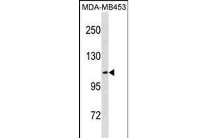 EN Antibody (C-term) (ABIN1881297 and ABIN2838760) western blot analysis in MDA-M cell line lysates (35 μg/lane). (ENPP3 抗体  (C-Term))