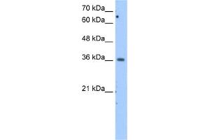 WB Suggested Anti-MDH1 Antibody Titration:  2. (MDH1 抗体  (Middle Region))