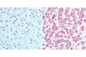 Image no. 1 for anti-Cellular Retinoic Acid Binding Protein 2 (CRABP2) (AA 75-125) antibody (ABIN960117) (CRABP2 抗体  (AA 75-125))