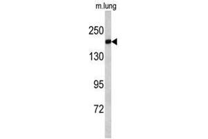 Image no. 1 for anti-Amyotrophic Lateral Sclerosis 2 (Juvenile) (ALS2) (C-Term) antibody (ABIN452733) (ALS2 抗体  (C-Term))