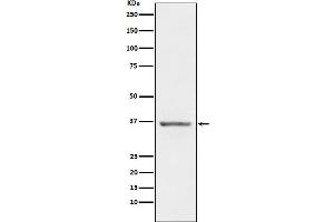 Western blot analysis of STC1 expression in Human Prostate lysate.