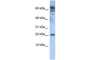 WB Suggested Anti-LDOC1 Antibody Titration:  0. (LDOC1 抗体  (N-Term))