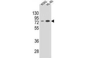 Western Blotting (WB) image for anti-Ectonucleoside Triphosphate diphosphohydrolase 3 (ENTPD3) antibody (ABIN2995799)