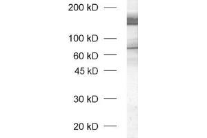 dilution: 1 : 1000, sample: rat brain honogenate (unboiled sample) (Neurexin 1 抗体  (AA 1328-1421))