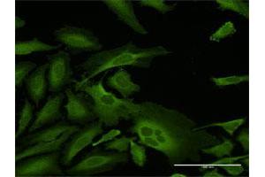Immunofluorescence of purified MaxPab antibody to CAP1 on HeLa cell. (CAP1 抗体  (AA 1-475))